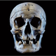 John Bellingham’s skull.